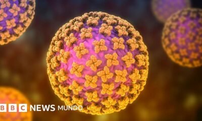 hantaviruscrucero — Cartel de alerta contra el hantavirus en un parque natural en Estados Unidos.