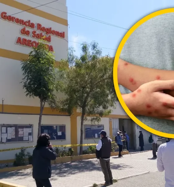 Arequipa confirma aumento — Imagen de la cobertura sobre Casos confirmados de sarampión aumentan a 13 en Arequipa y la mayoría de contagi. Foto de: El Búho