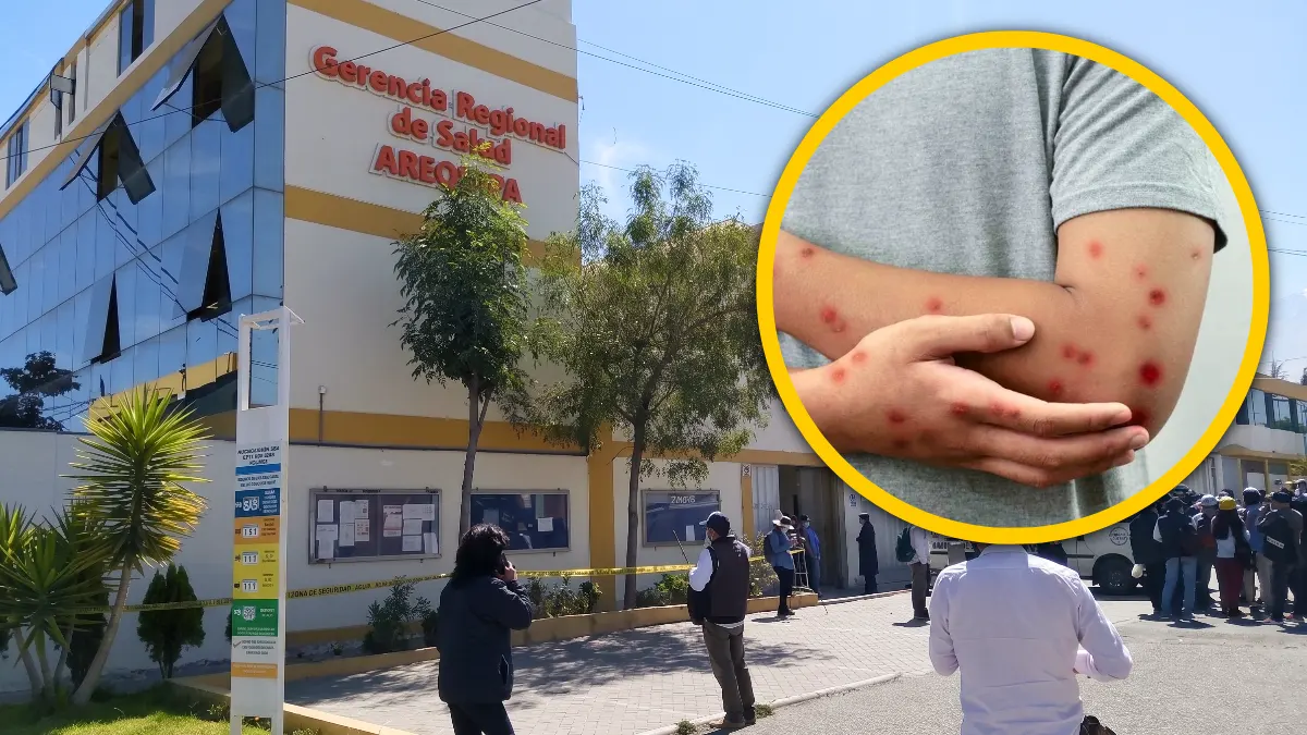 Arequipa confirma aumento — Imagen de la cobertura sobre Casos confirmados de sarampión aumentan a 13 en Arequipa y la mayoría de contagi. Foto de: El Búho