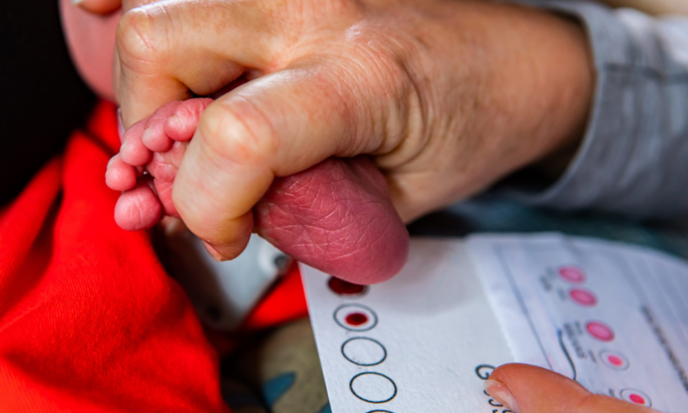 Un bebé es examinado por personal de salud como parte del programa de tamizaje para detectar hipotiroidismo congénito. Foto de: Perú21