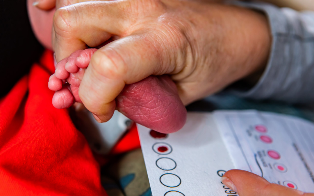 Un bebé es examinado por personal de salud como parte del programa de tamizaje para detectar hipotiroidismo congénito. Foto de: Perú21