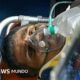 Hernán Gil es rescatado tras permanecer ocho días atrapado bajo los escombros de un edificio colapsado por sismos en Venezuela. Foto de: Getty Images